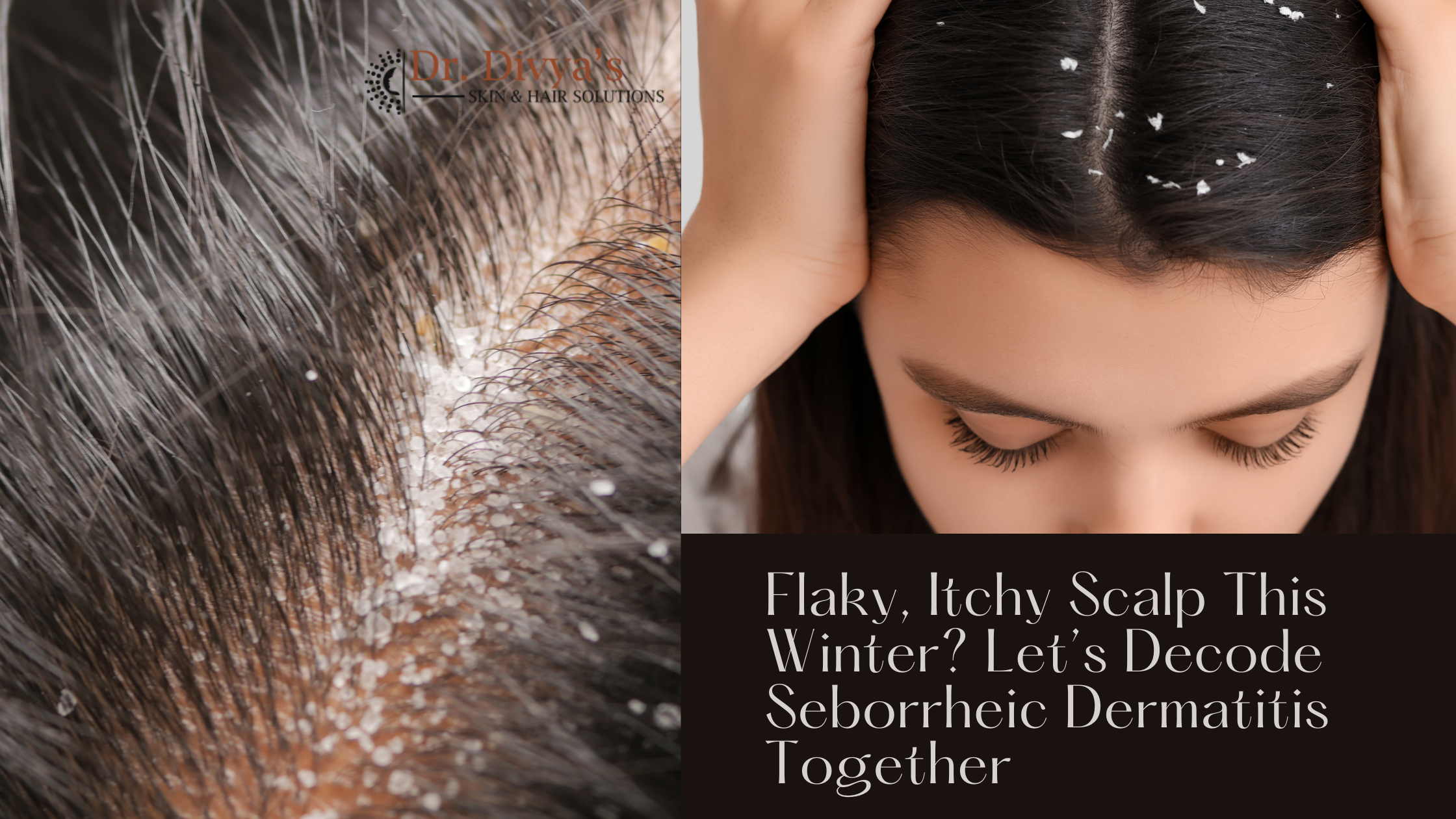 itchy scalp treatment