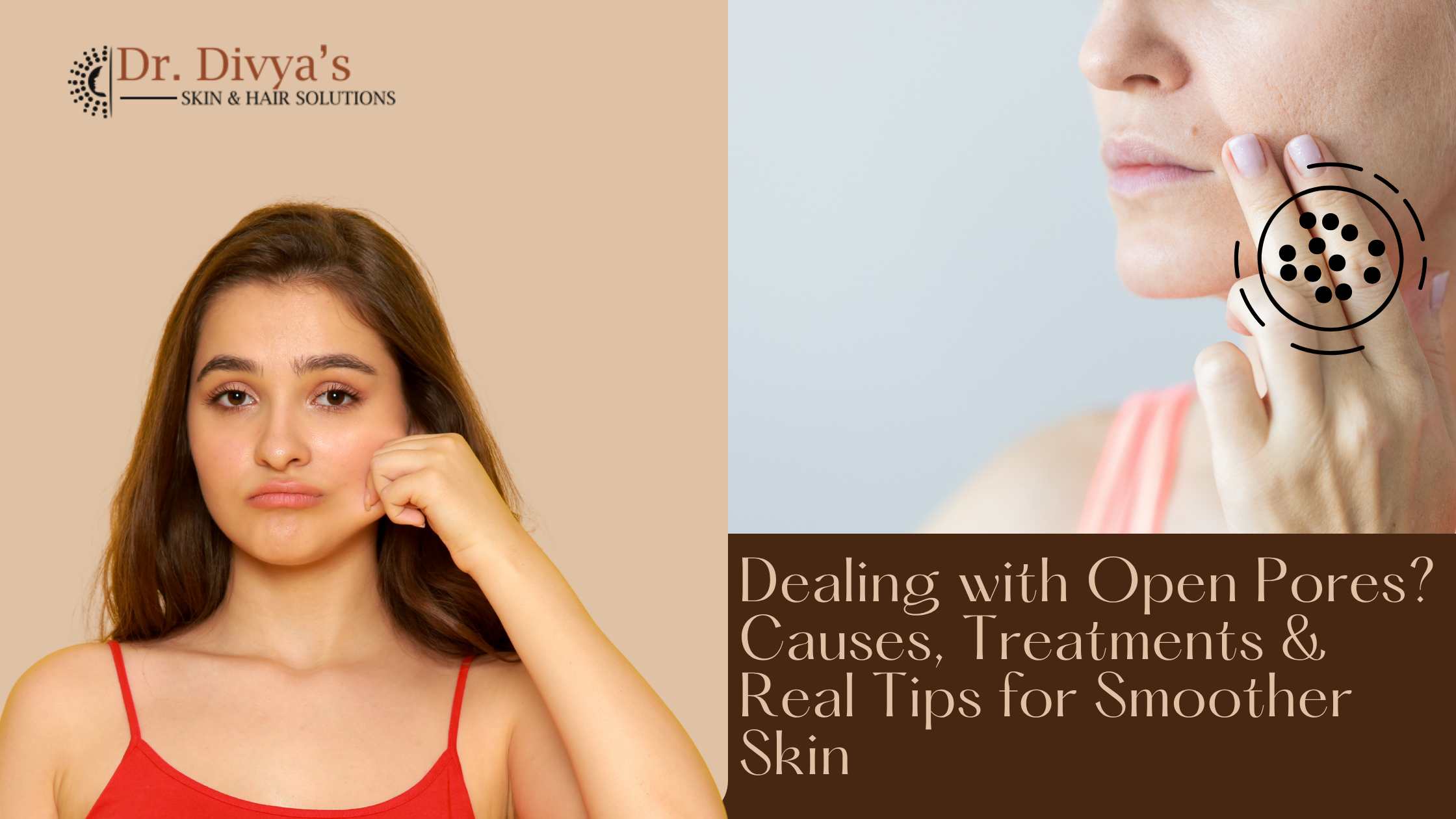 dealing with open pores 