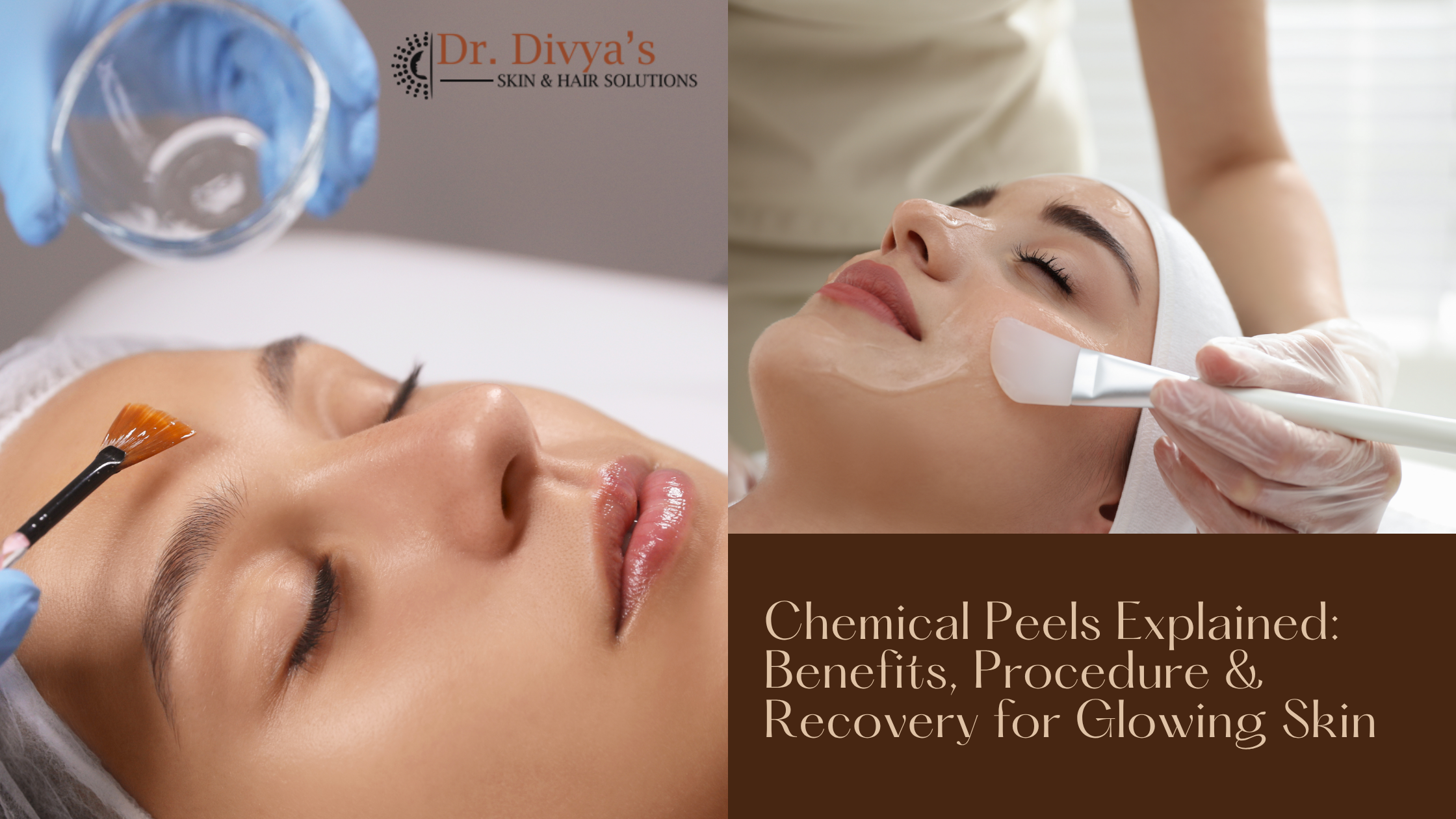 Benefits & Recovery of Chemical Peels