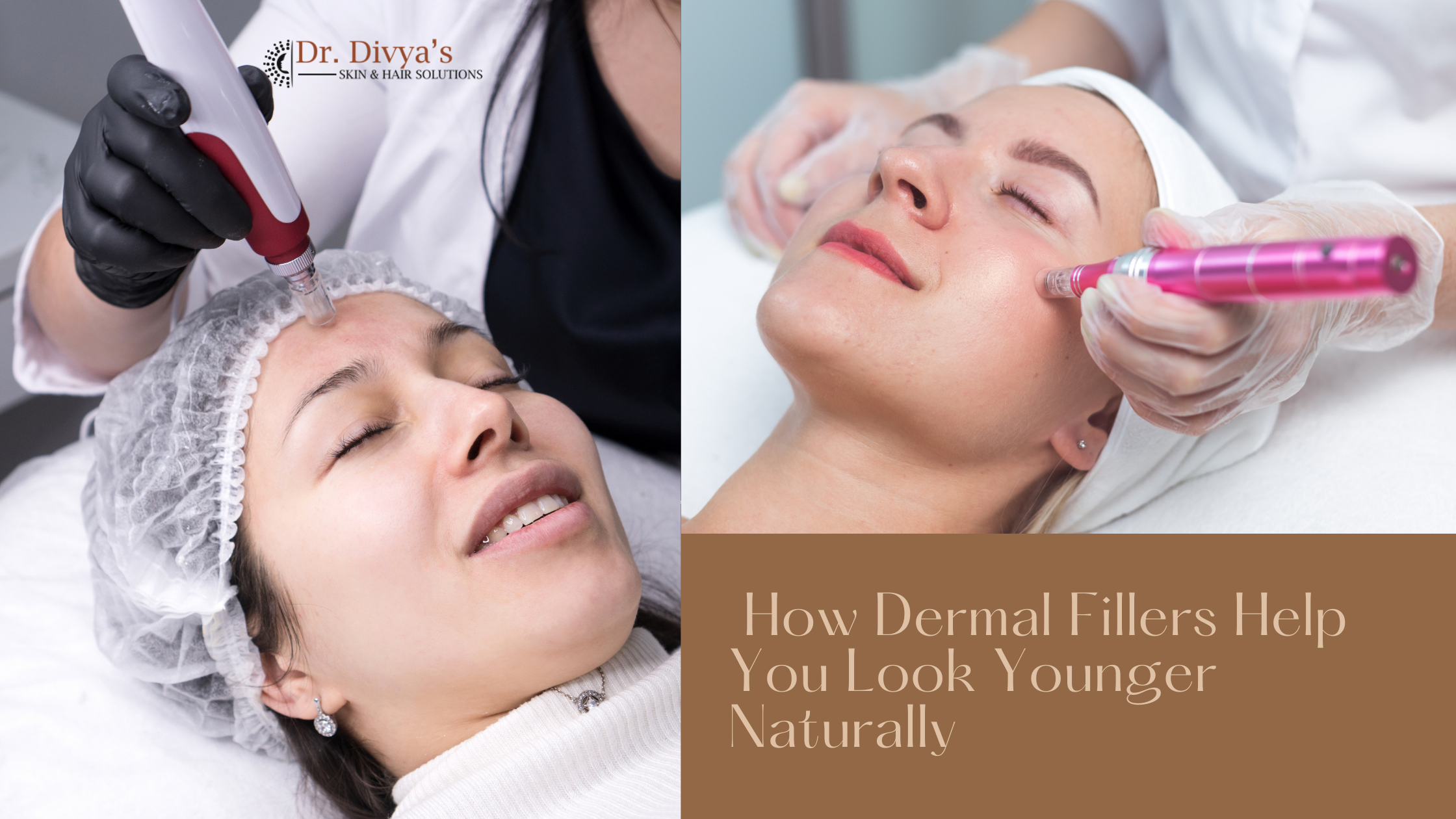 Dermal-Fillers-bangalore