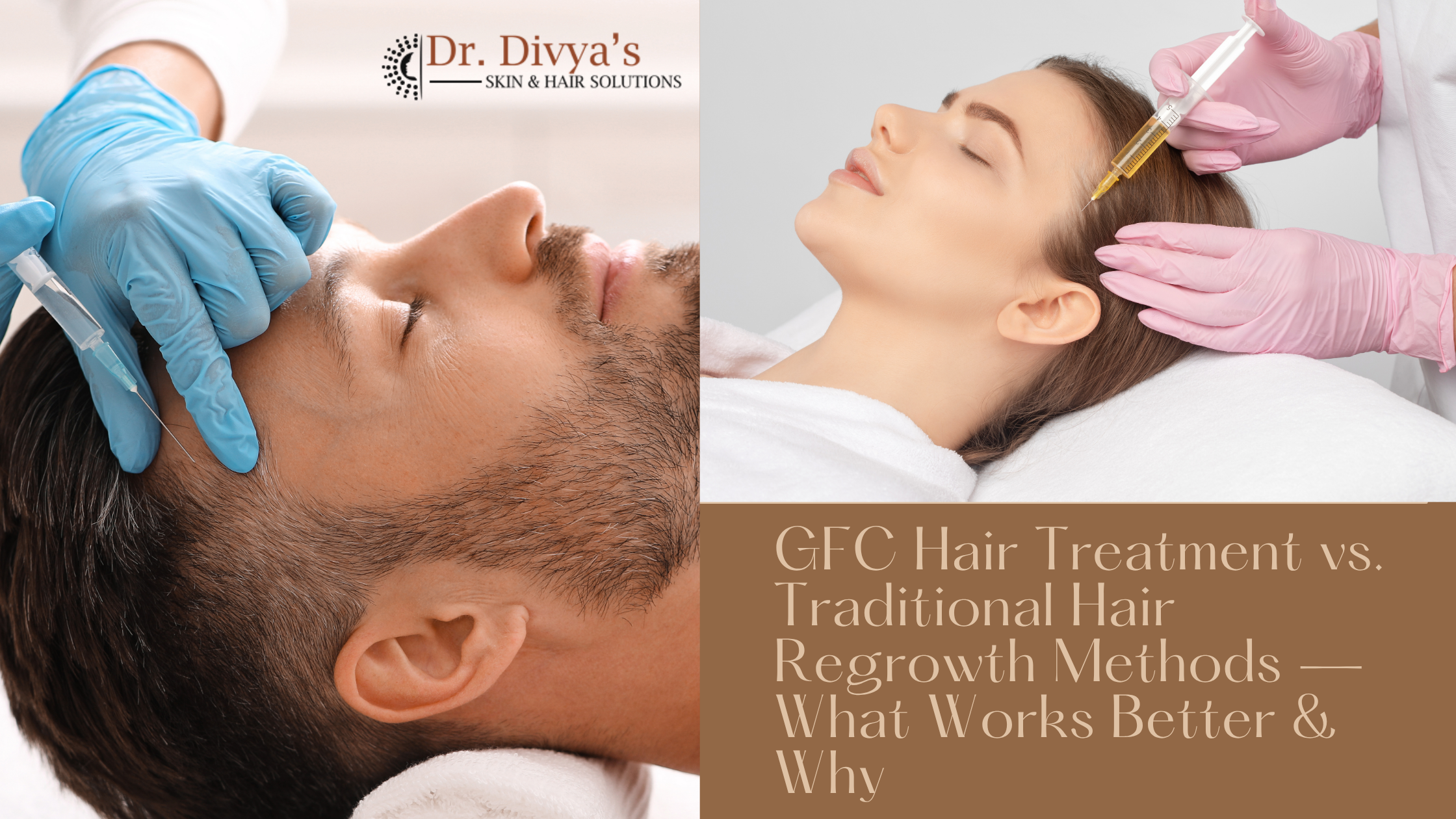 GFC Hair Treatment vs. Traditional Hair Regrowth Methods