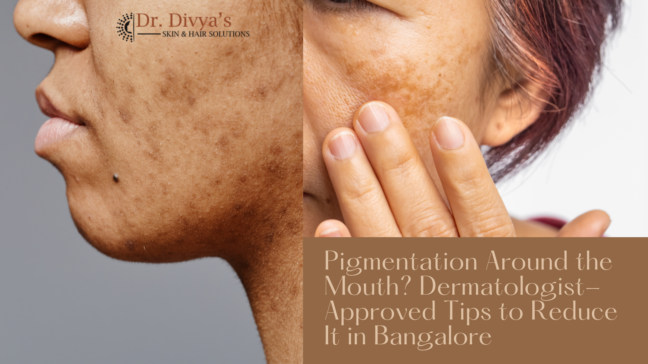 Tips to Reduce It in Bangalore