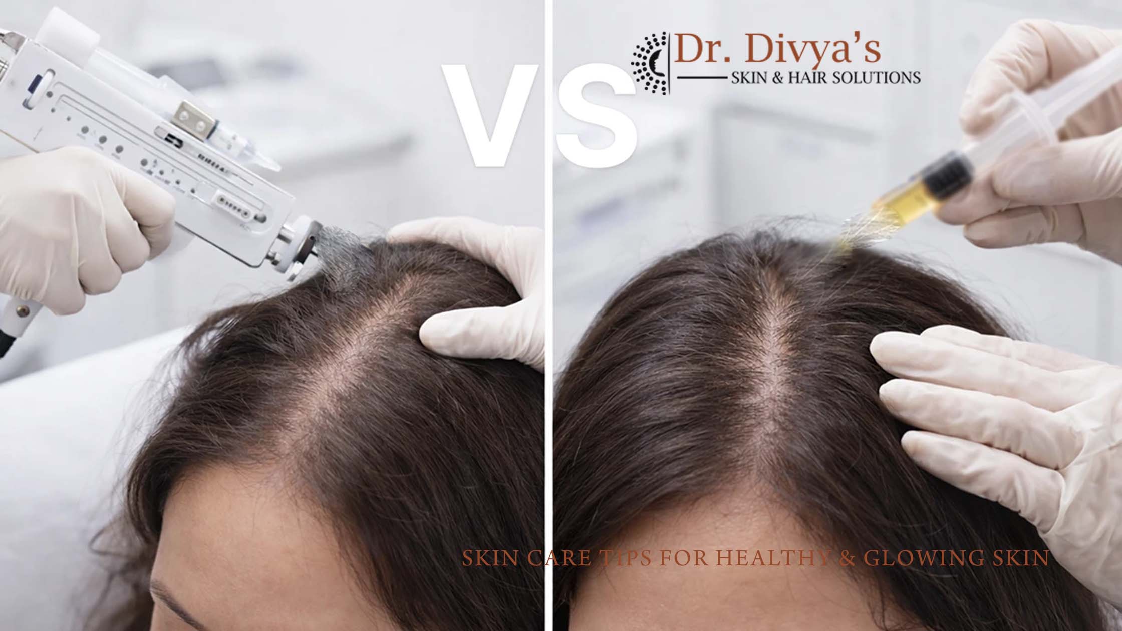 PRP Hair Treatment: Benefits & Procedure Explained 