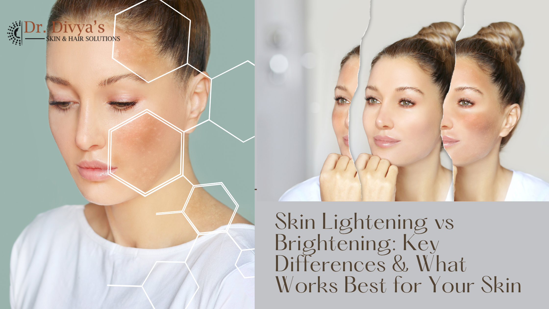 Skin Lightening vs Brightening