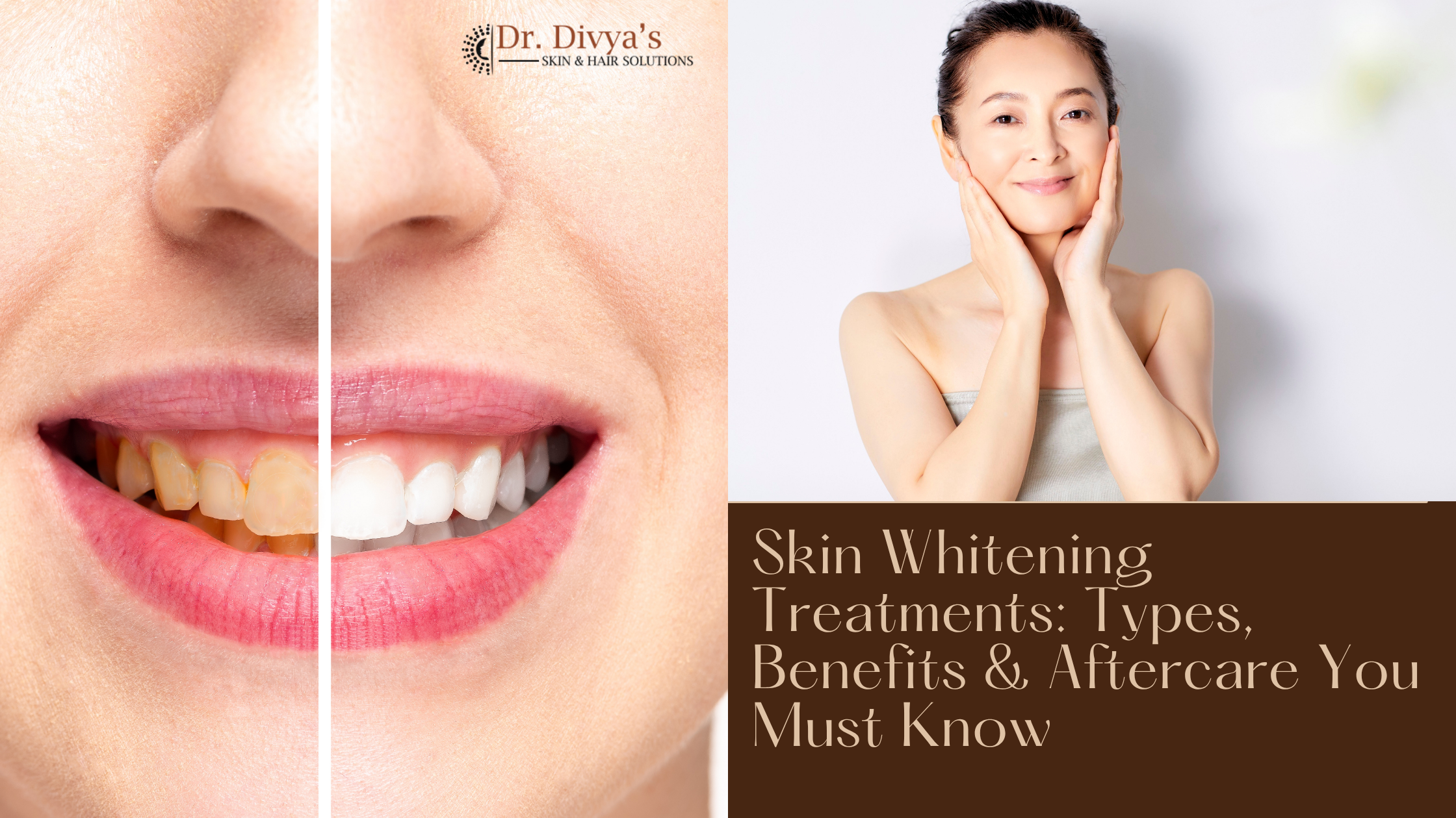 Skin Whitening Treatments