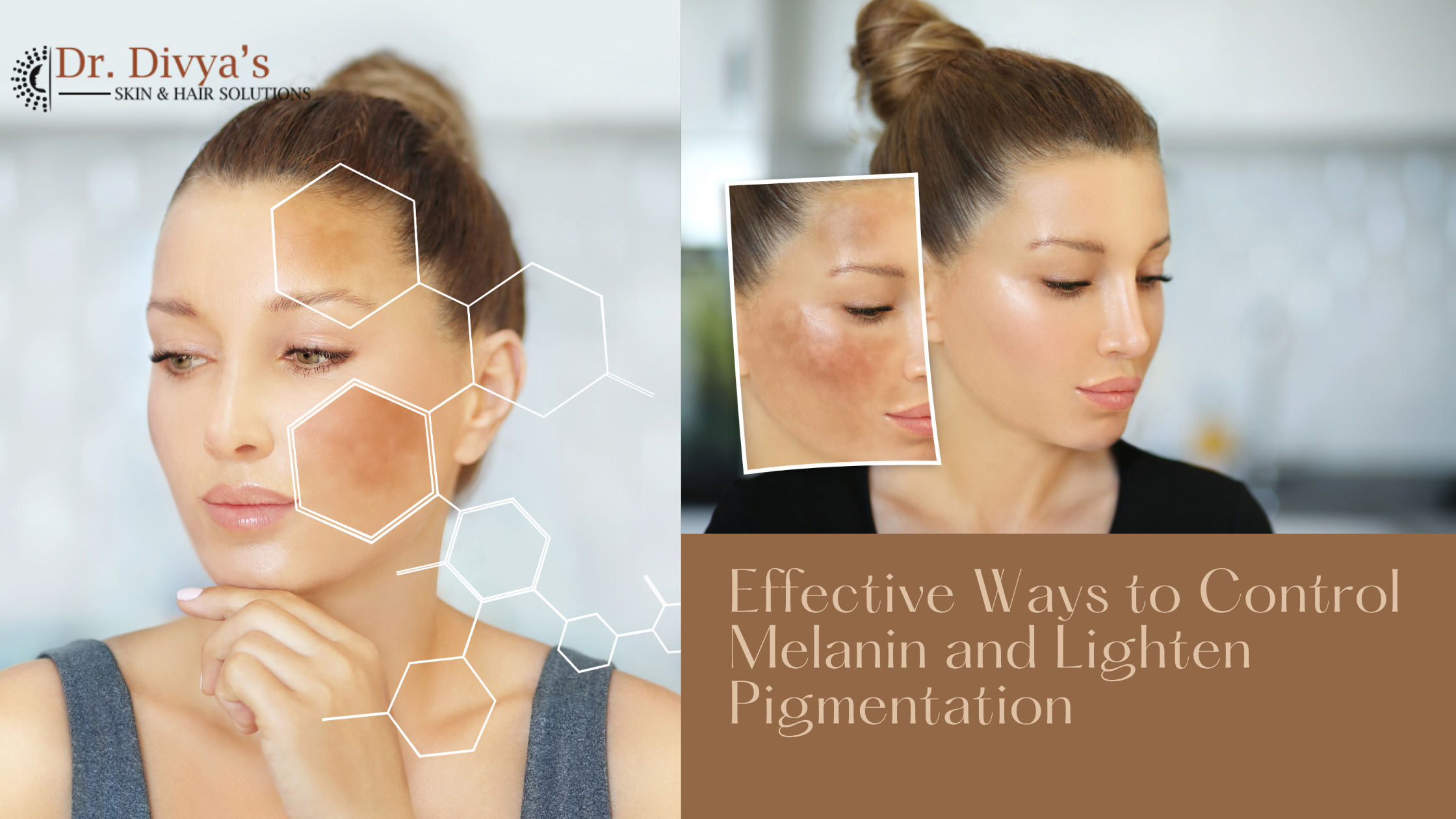 Effective Ways to Control Melanin