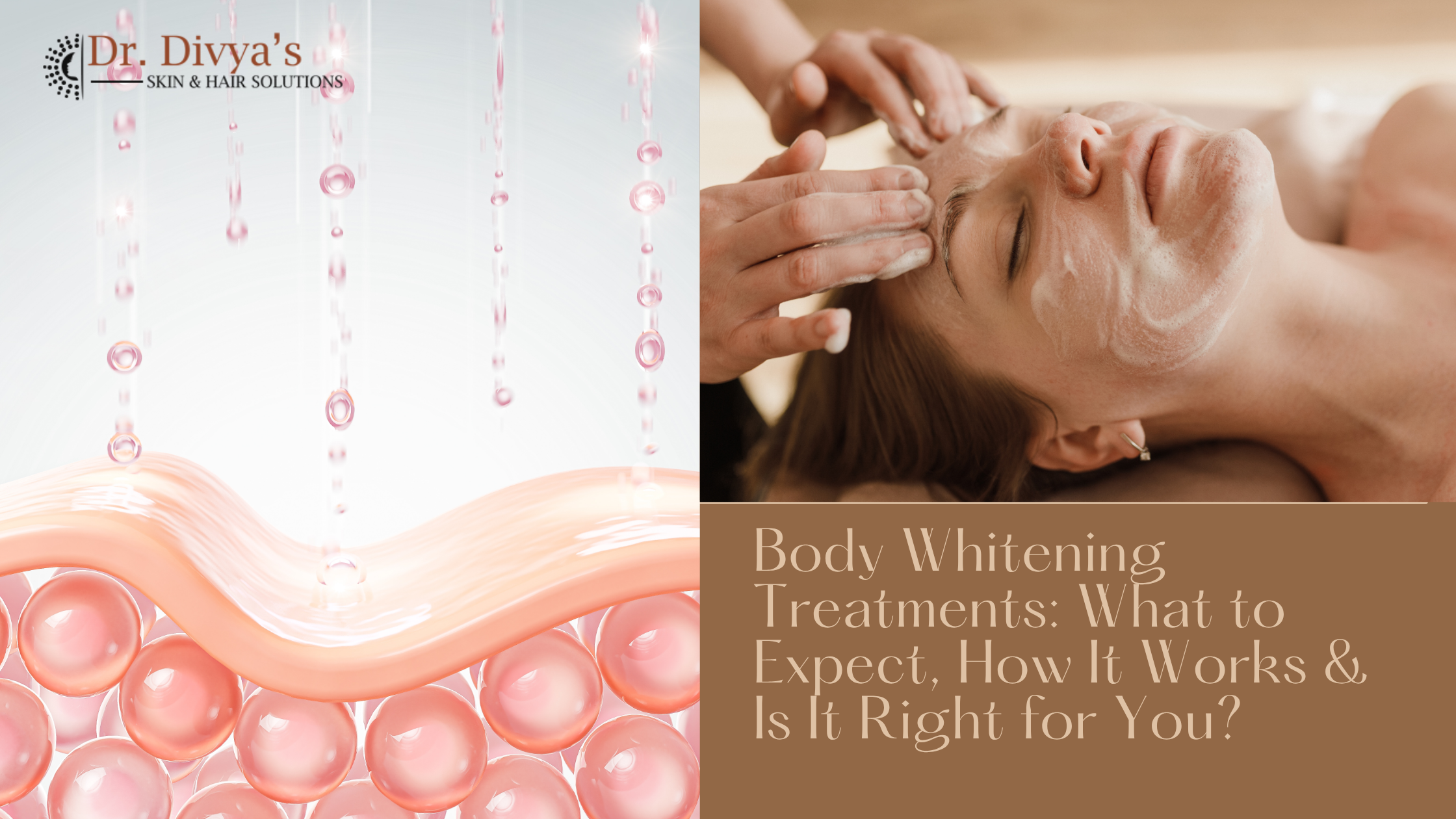 Body Whitening Treatments