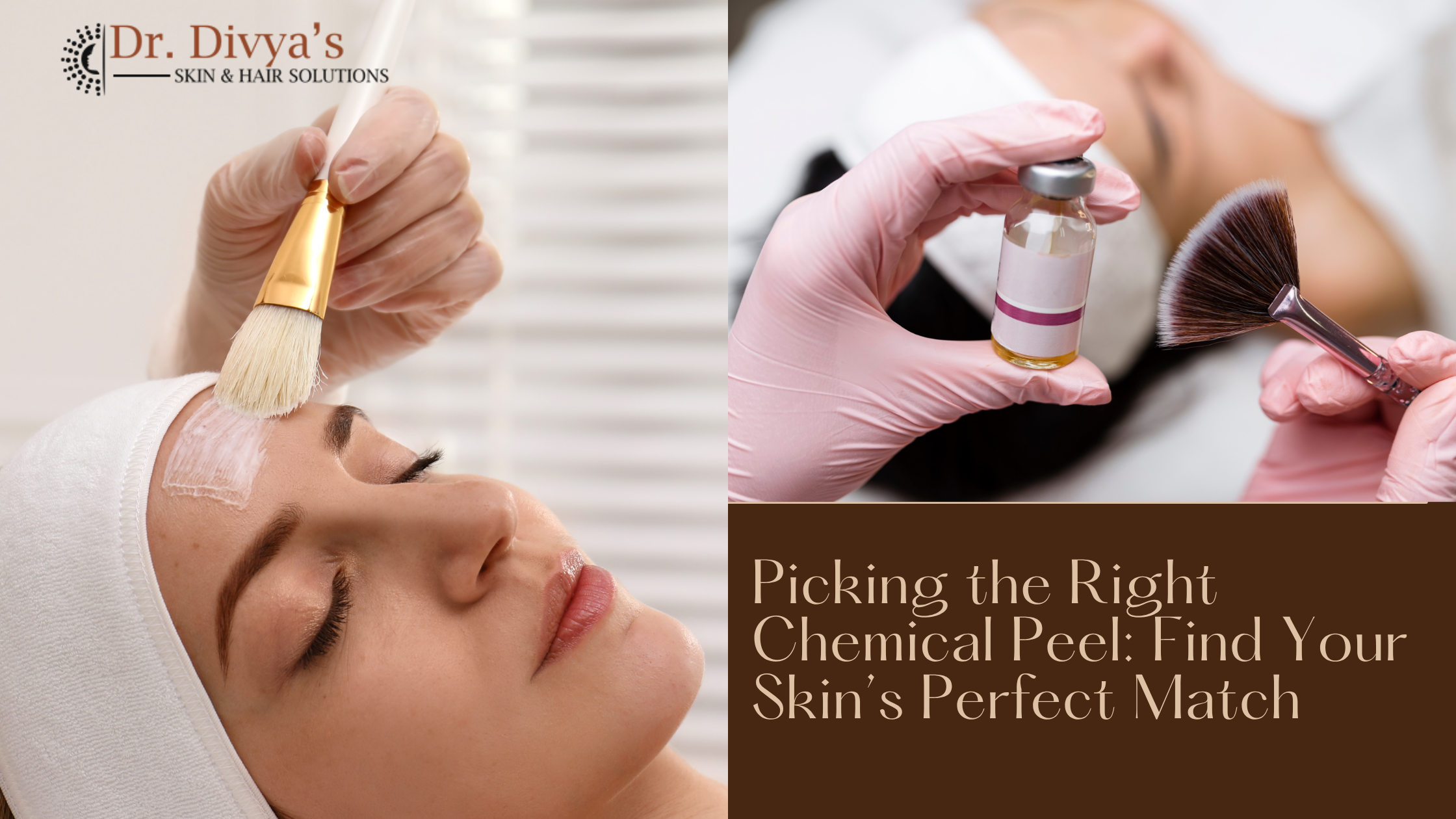 Right Chemical Peel