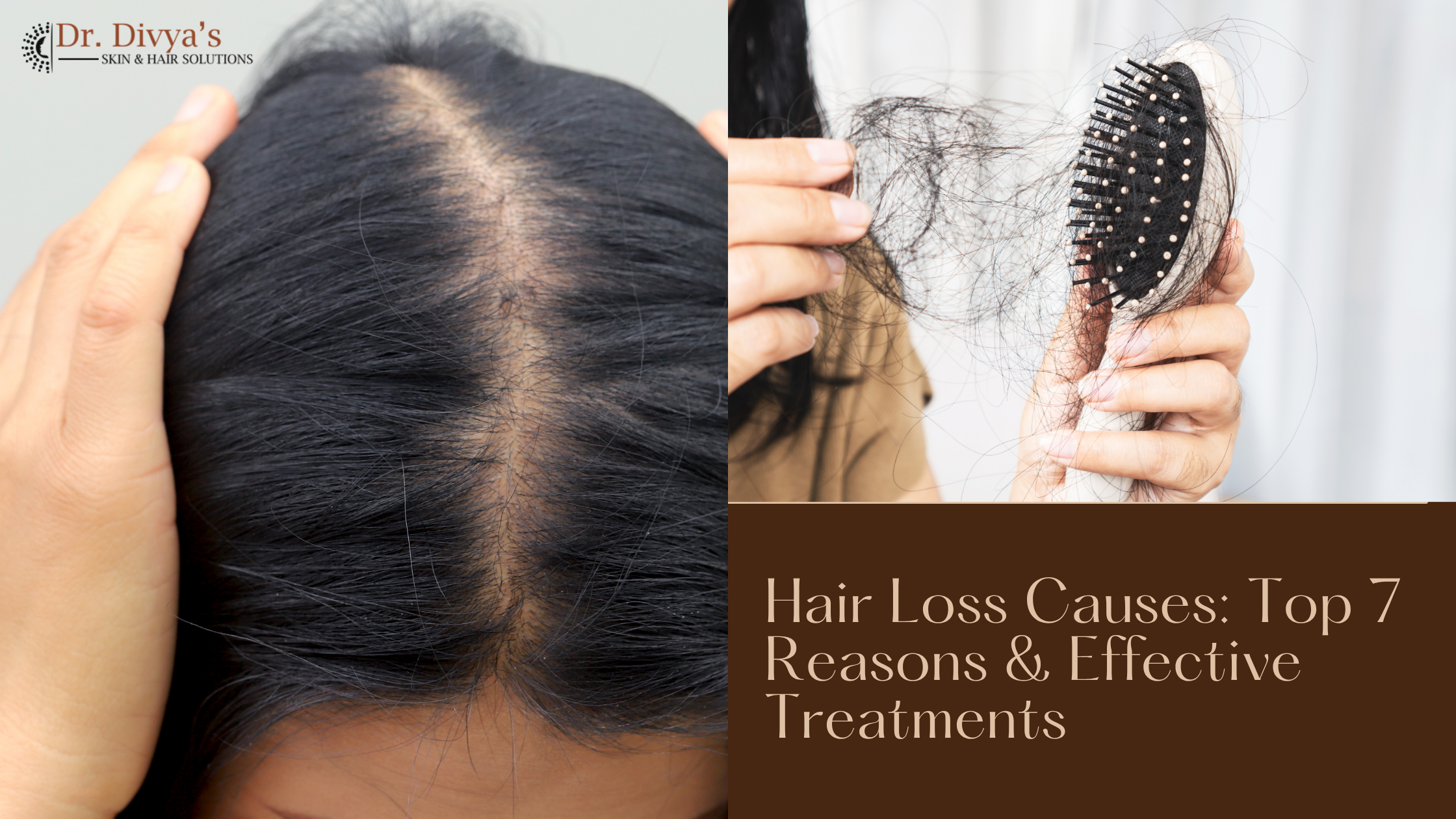 Hair Loss Causes and treatments