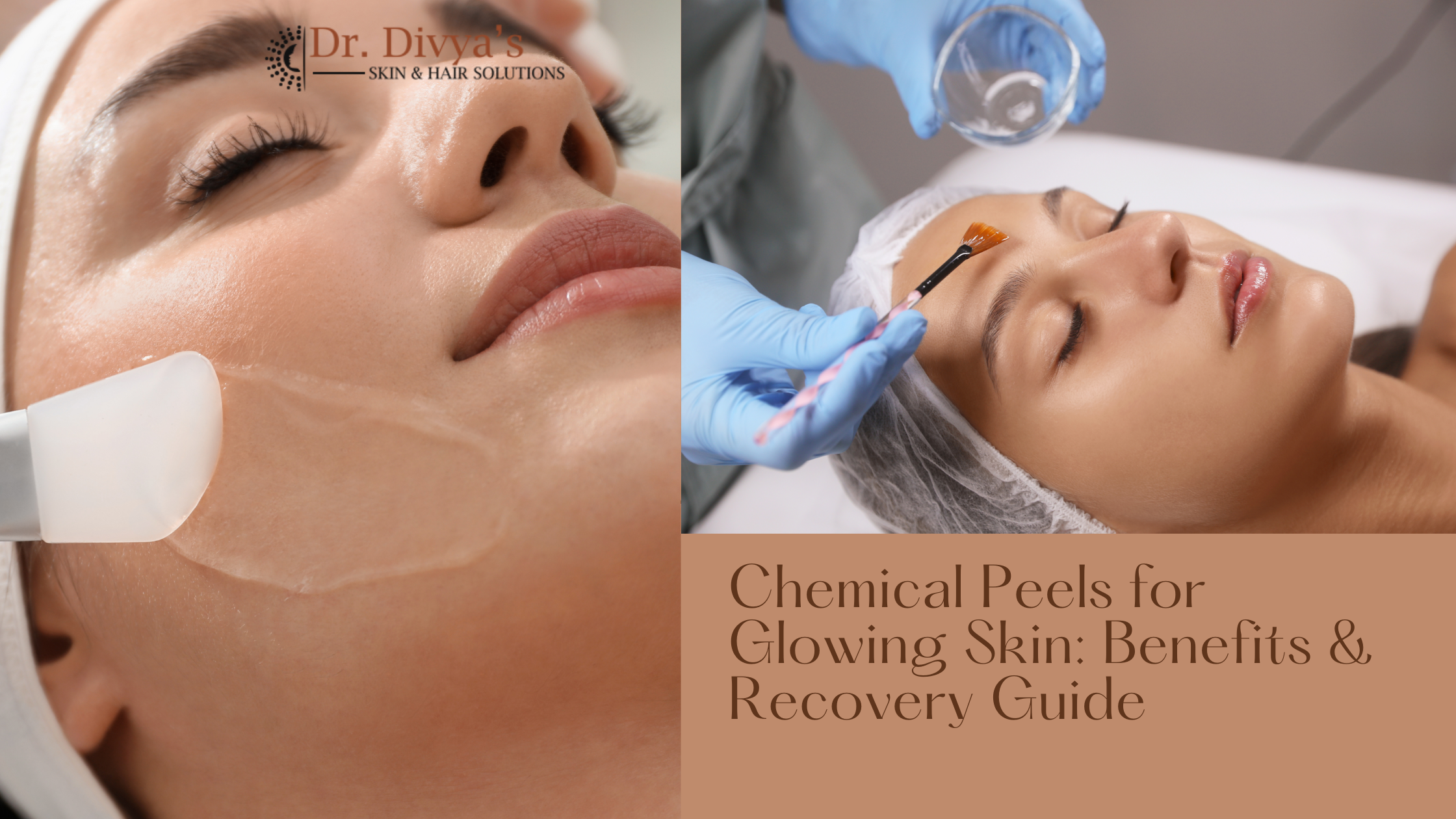 Chemical Peels for Glowing Skin