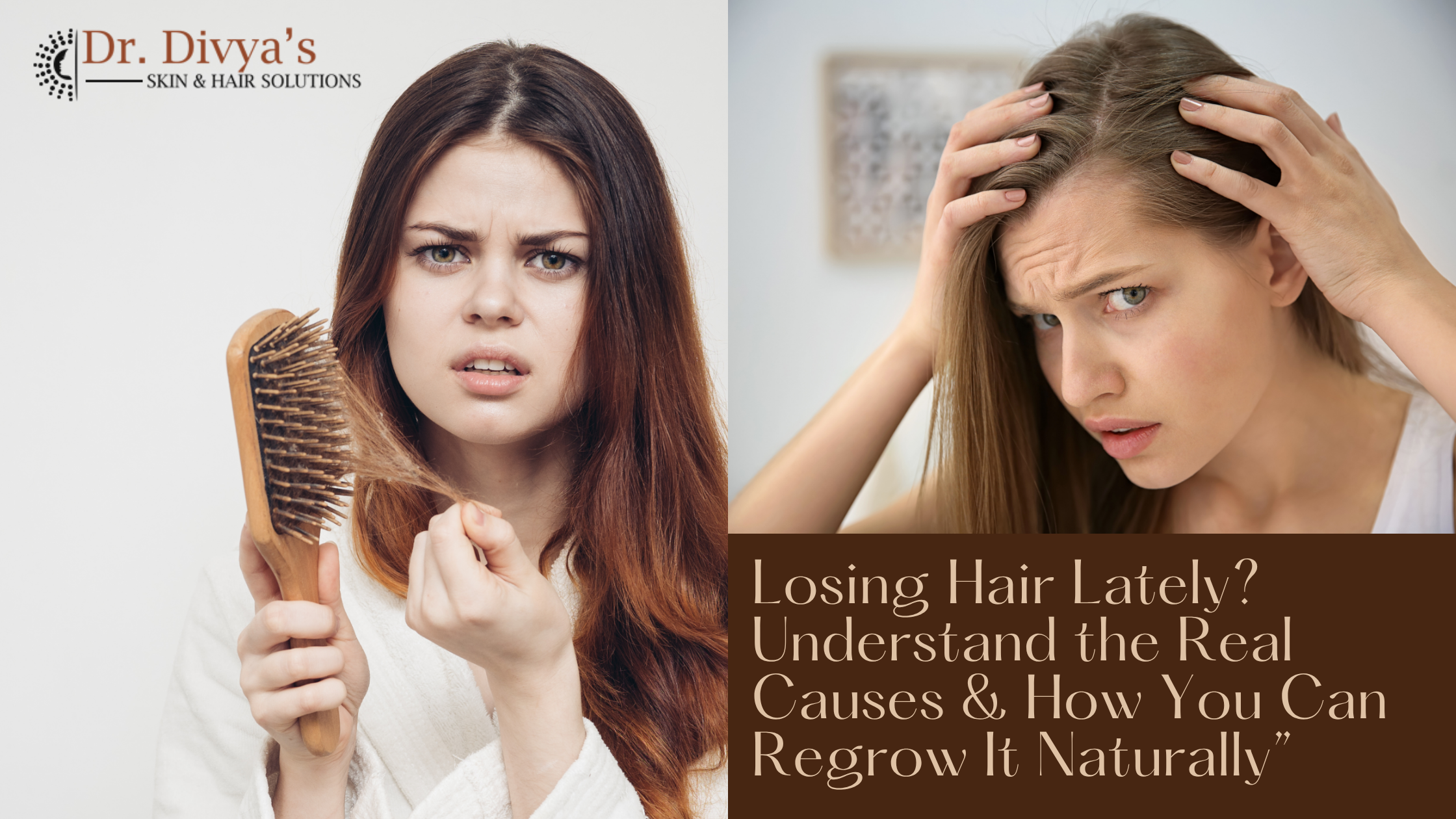  Losing Hair
