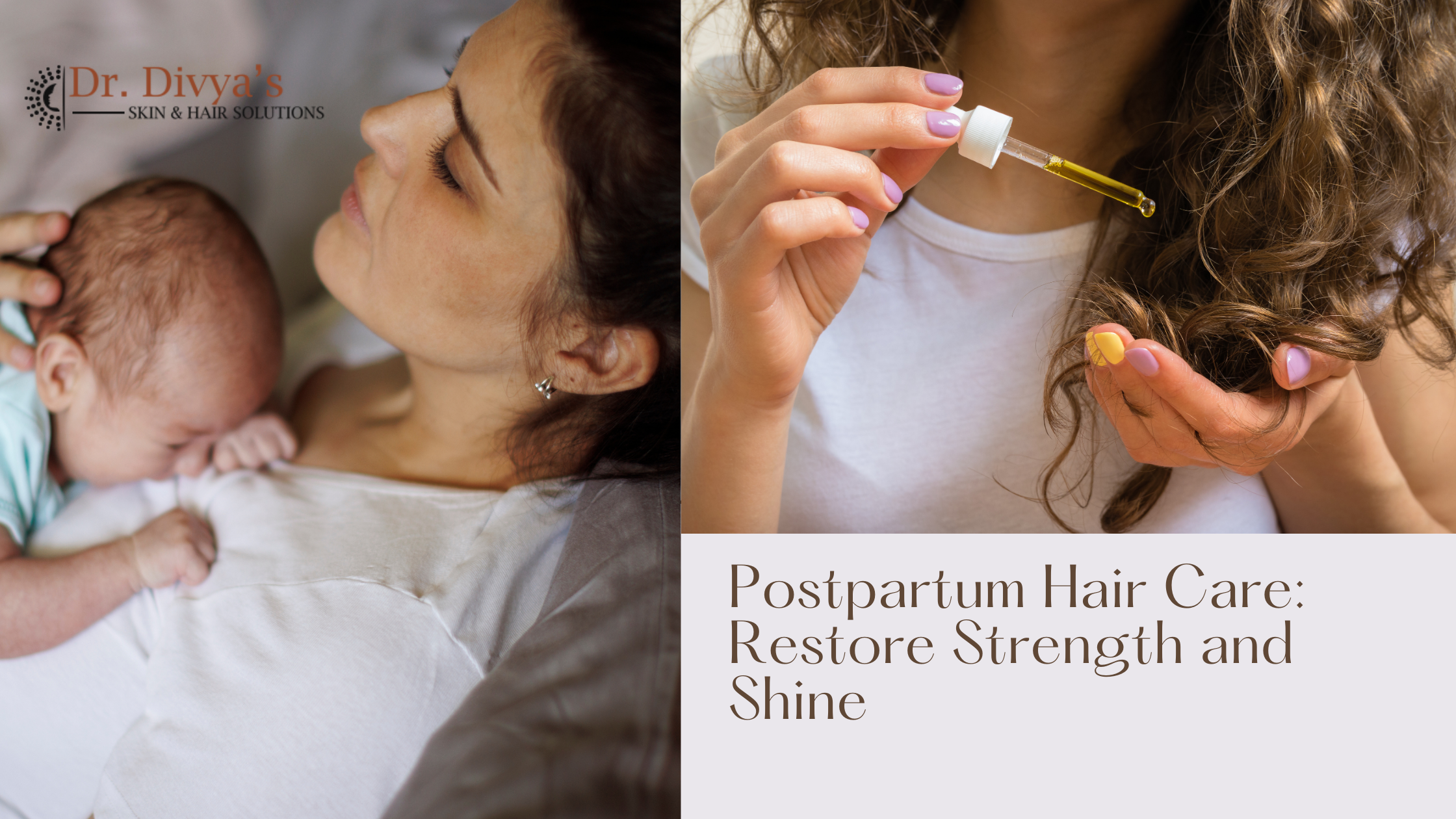Postpartum Hair Care in bangalore