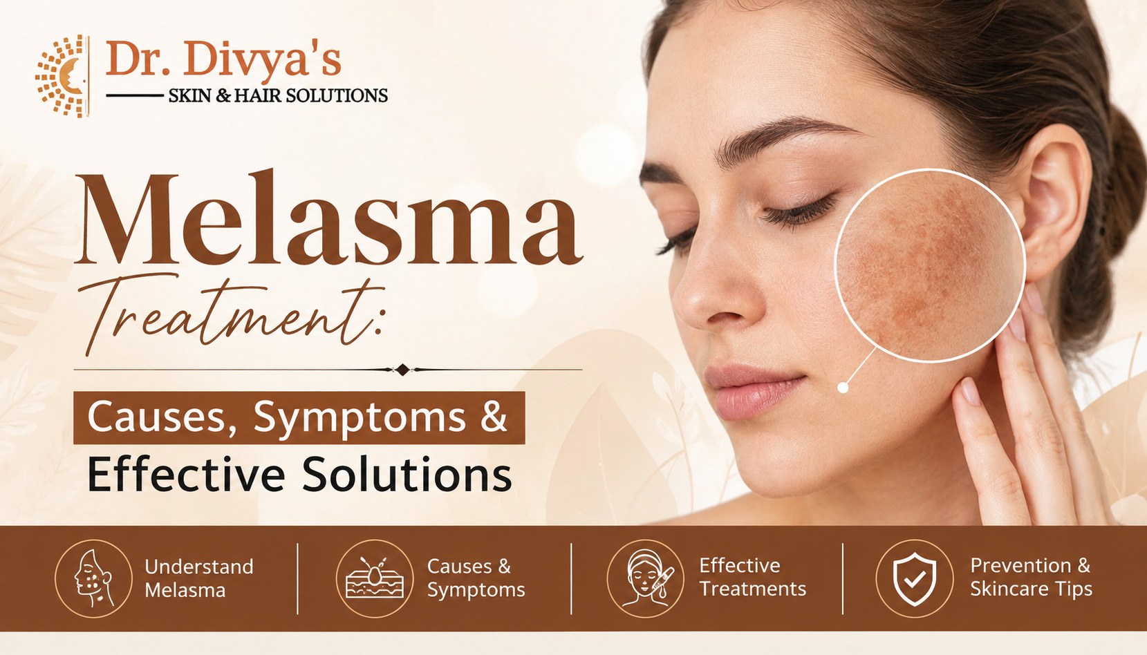 Melasma Treatment
