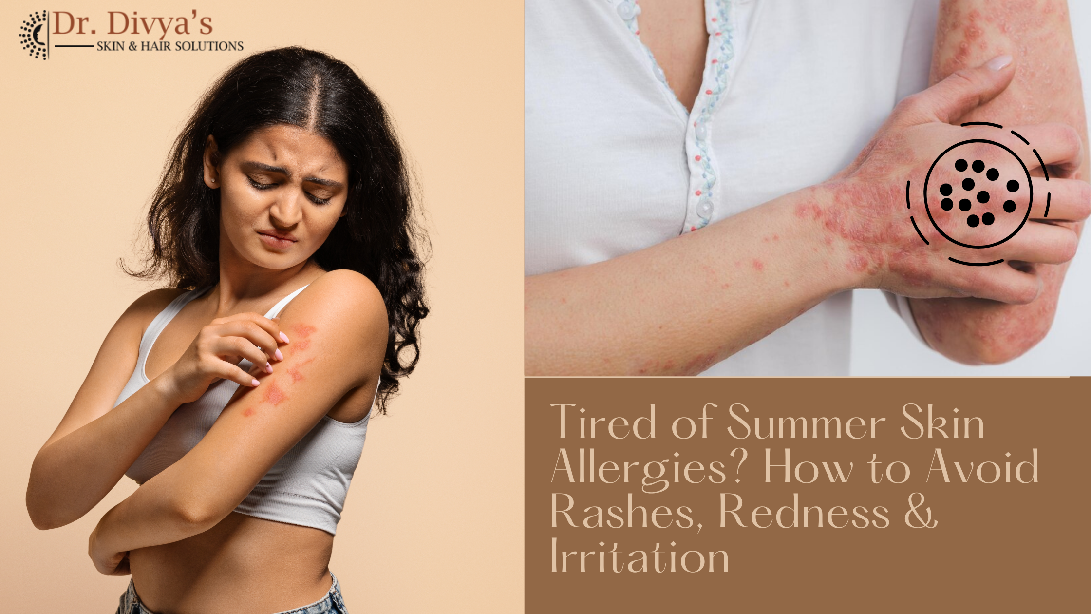 Summer-Skin-Allergies