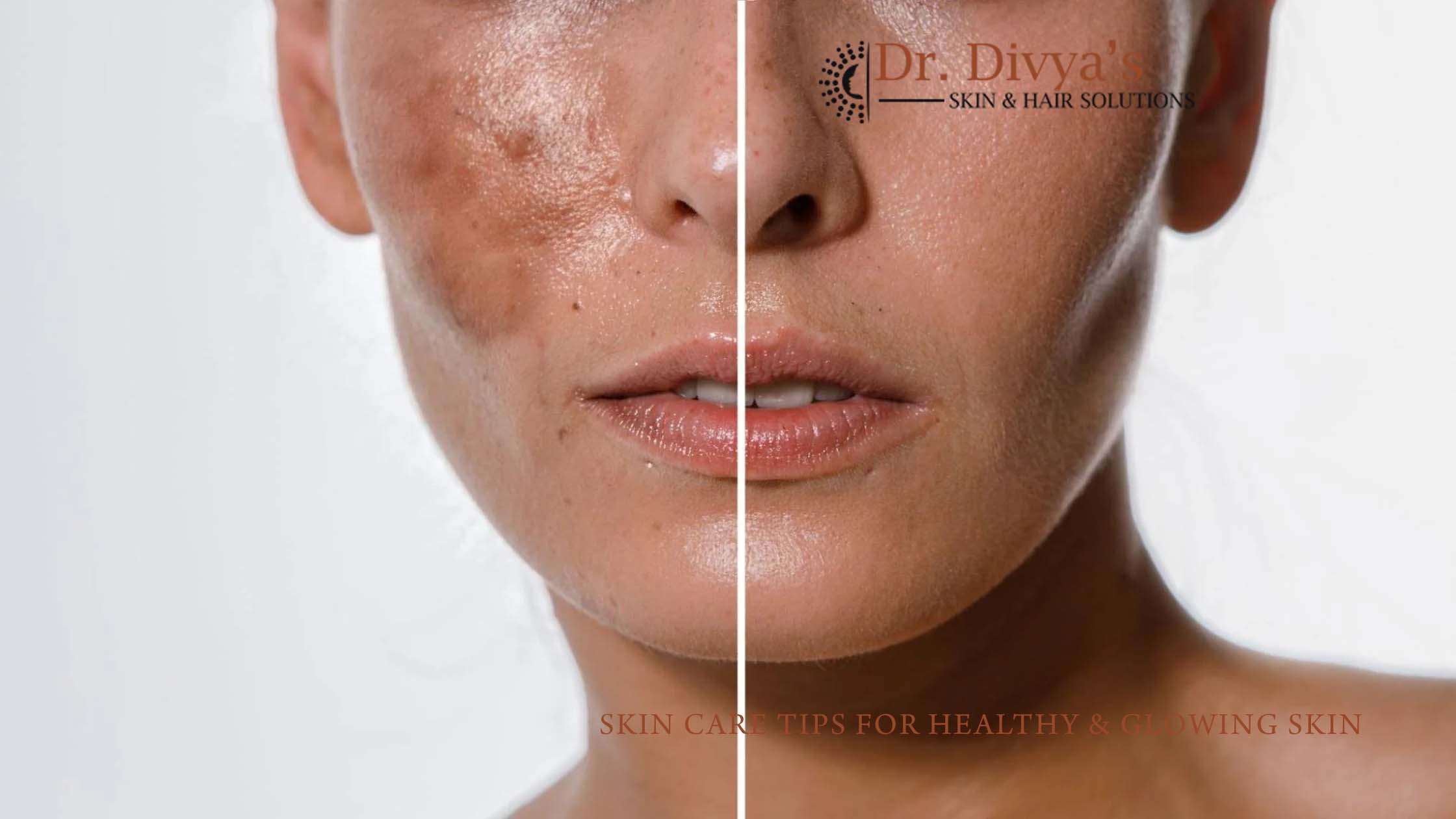 Causes of Pigmentation and Effective Treatment