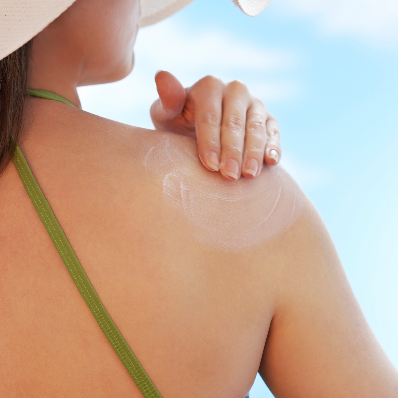 How to make sunburns go away faster? | Skin Doctor Near Me | Dr. Divya