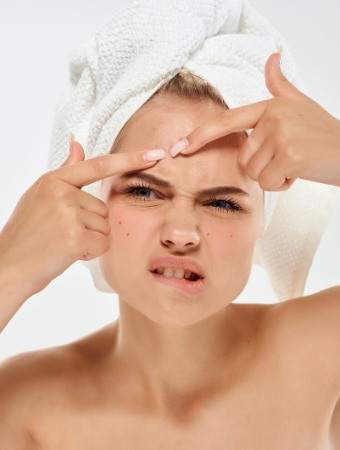 remedies for pimple