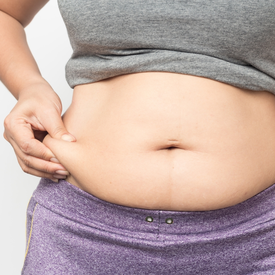 PCOS and obesity