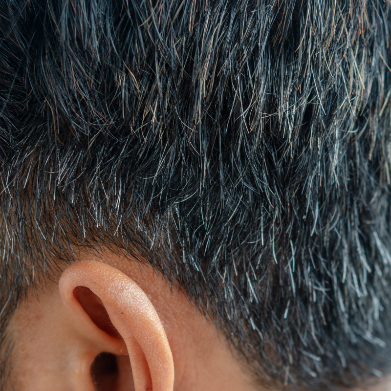 What are the causes of premature hair greying in men?
