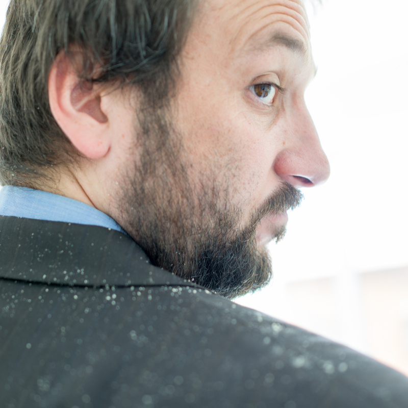 What is the solution for dandruff?
