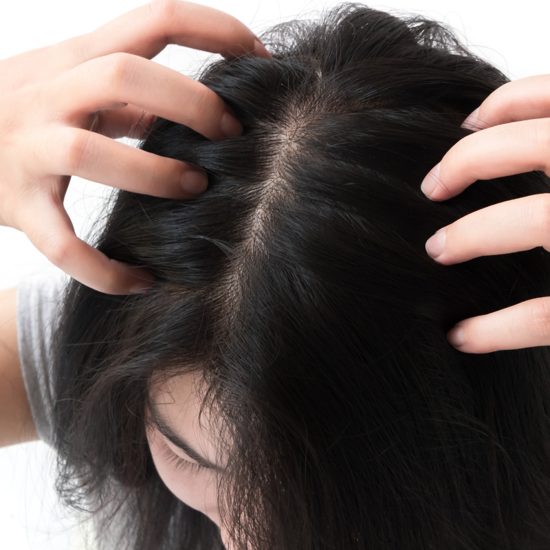 How to soothe an itchy scalp?