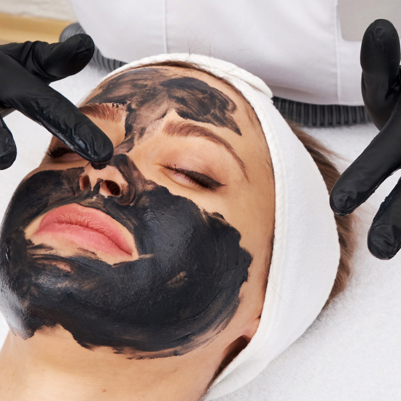 What happens to my skin during the Hollywood Peel procedure?