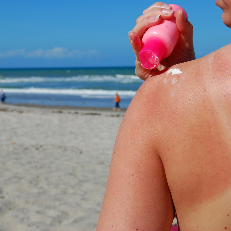 How does drinking water help reduce sunburns and blisters? | Dr. Divya