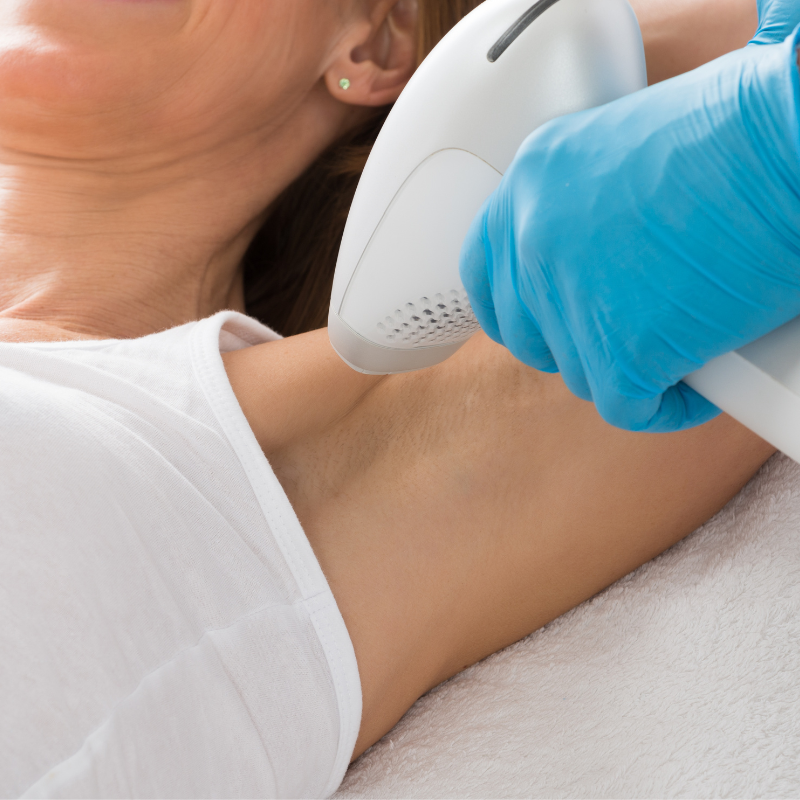 Consulting dermatologist for laser hair removal
